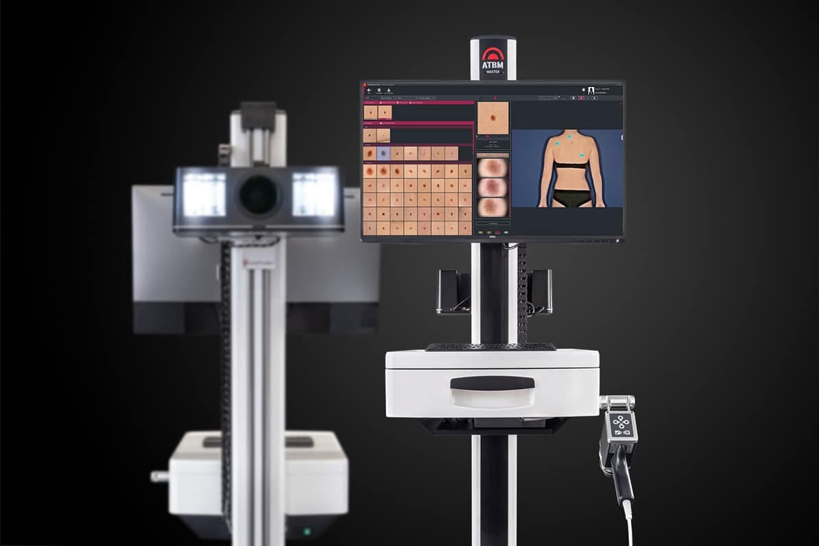 FotoFinder ATBM master mit Kamera und Monitor