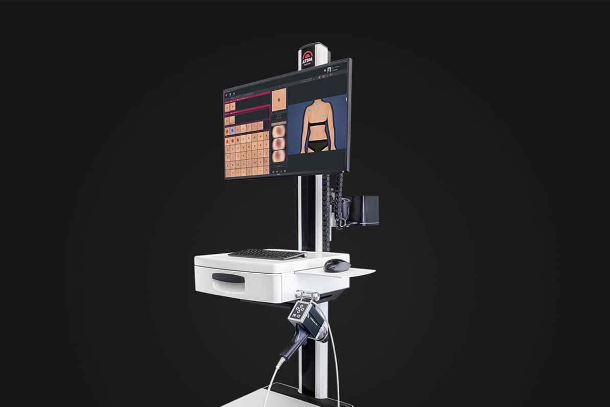 FotoFinder ATBM master in der Seitenansicht
